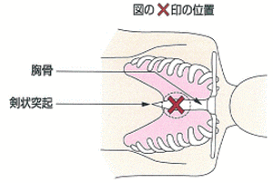 胸骨圧迫の位置のイラスト